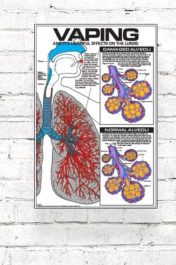 An anatomical illustration showing lungs with areas of scarring or damage from prolonged vaping.